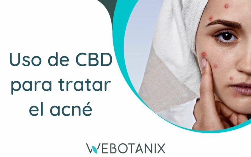 cbd para el acne